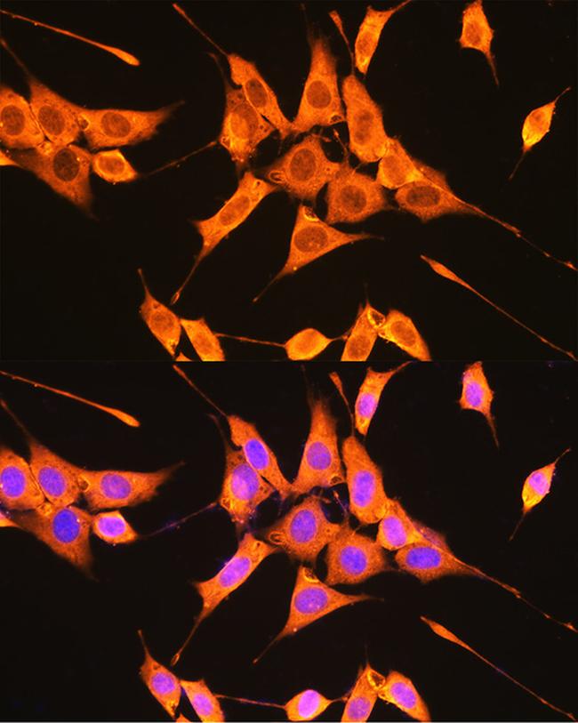 PKM2 Antibody in Immunocytochemistry (ICC/IF)