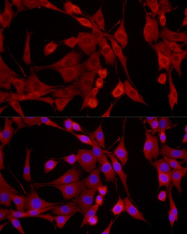 EPHX2 Antibody in Immunocytochemistry (ICC/IF)