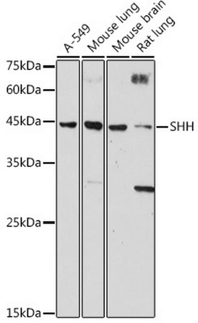 SHH Antibody in Western Blot (WB)