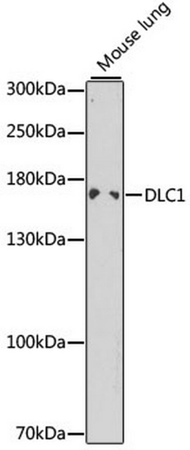 DLC1 Antibody in Western Blot (WB)