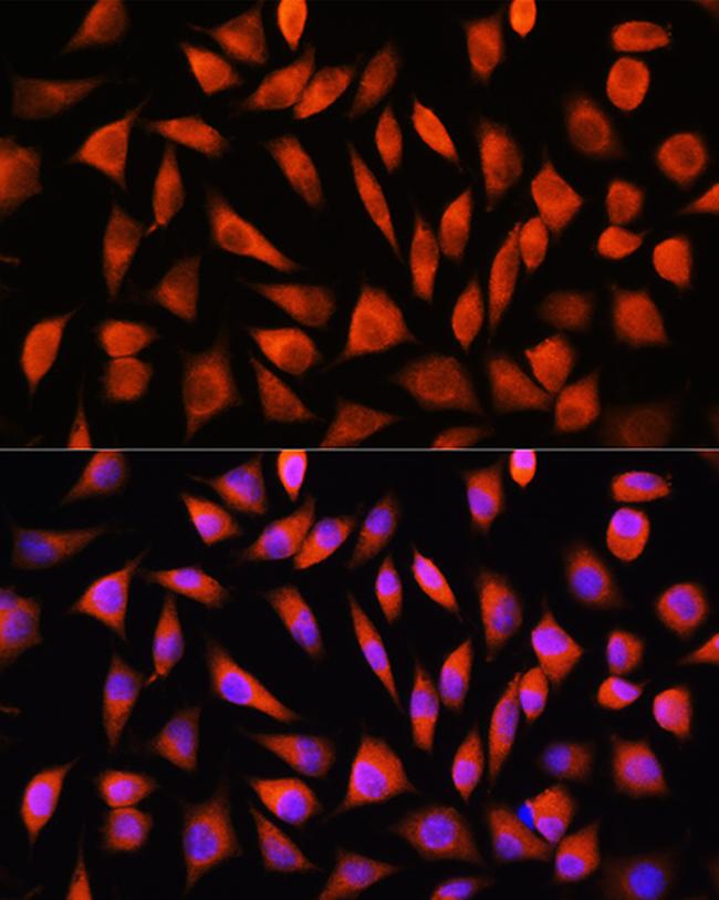 RhoG Antibody in Immunocytochemistry (ICC/IF)