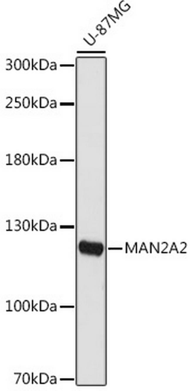 MAN2A2 Antibody in Western Blot (WB)