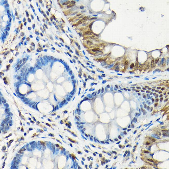 SMAD5 Antibody in Immunohistochemistry (Paraffin) (IHC (P))