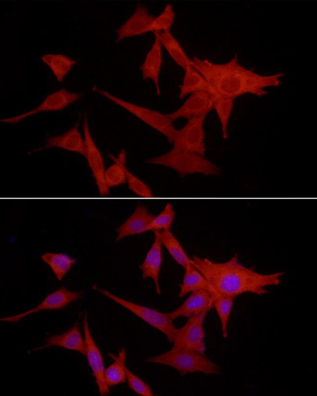 S100A10 Antibody in Immunocytochemistry (ICC/IF)