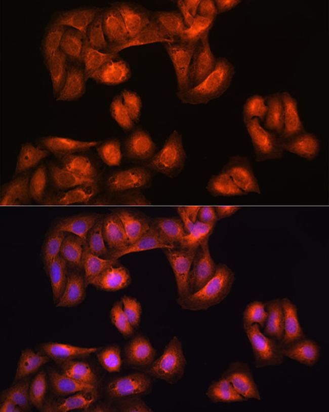 PHGDH Antibody in Immunocytochemistry (ICC/IF)