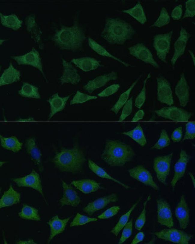 CDw293 Antibody in Immunocytochemistry (ICC/IF)