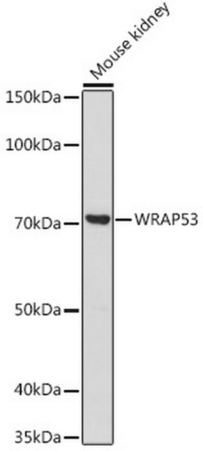 WRAP53 Antibody in Western Blot (WB)