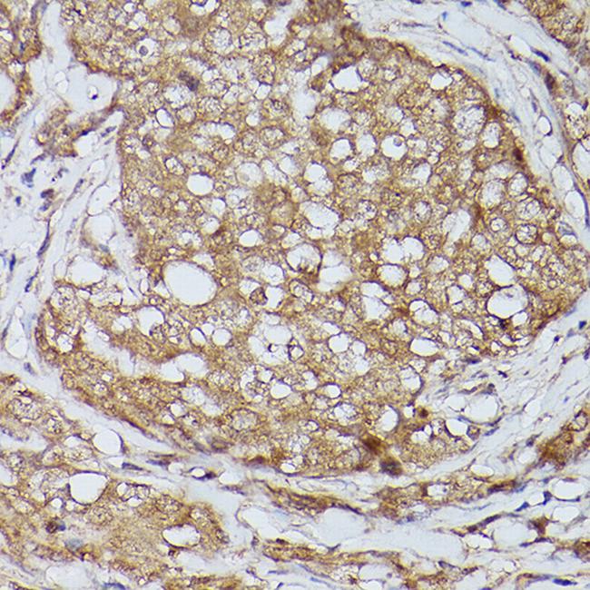 ZIP11 Antibody in Immunohistochemistry (Paraffin) (IHC (P))