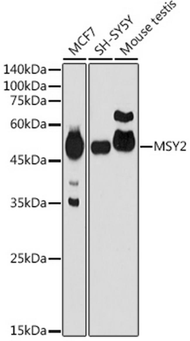 YBX2 Antibody in Western Blot (WB)