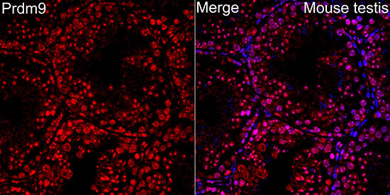 PRDM9 Antibody in Immunocytochemistry (ICC/IF)