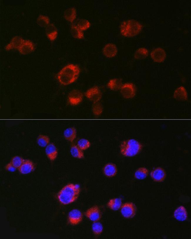 HTR2A Antibody in Immunocytochemistry (ICC/IF)