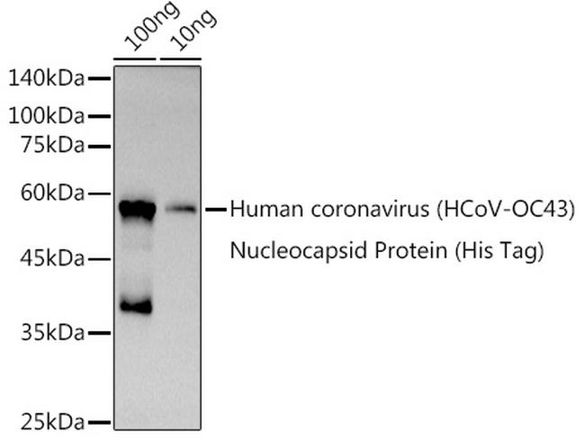 HCoV-OC43 Nucleoprotein Antibody in Western Blot (WB)