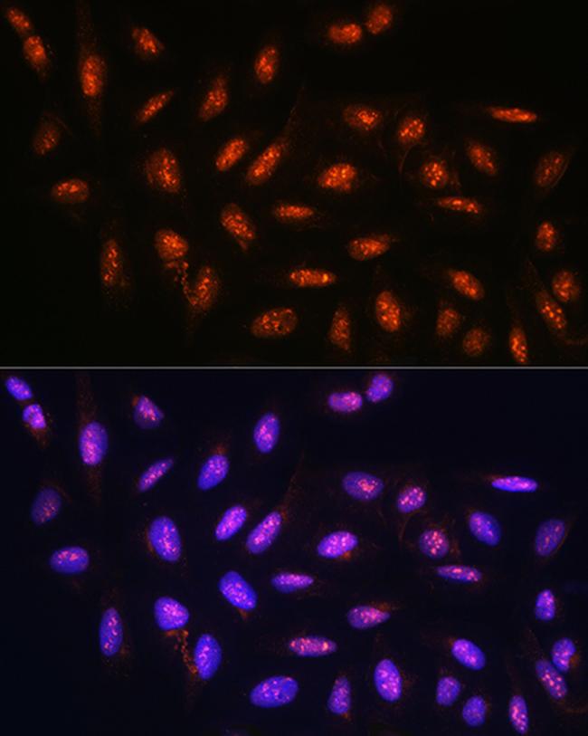 FANCD2 Antibody in Immunocytochemistry (ICC/IF)