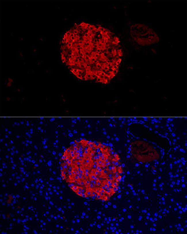 Insulin Antibody in Immunocytochemistry (ICC/IF)