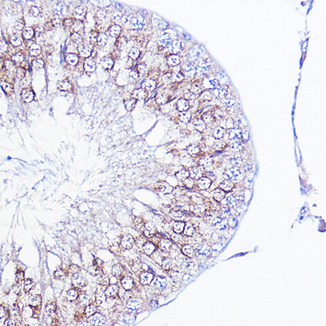 Integrin alpha V (CD51) Antibody in Immunohistochemistry (Paraffin) (IHC (P))