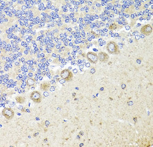 TrkA Antibody in Immunohistochemistry (Paraffin) (IHC (P))