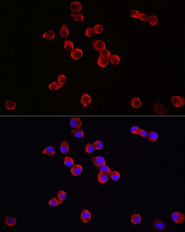 TrkB Antibody in Immunocytochemistry (ICC/IF)