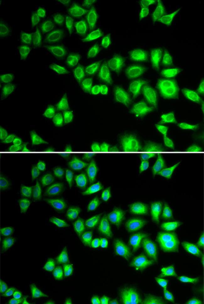 Cullin 1 Antibody in Immunocytochemistry (ICC/IF)