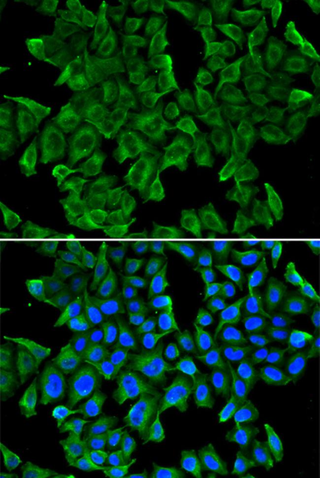 REG3G Antibody in Immunocytochemistry (ICC/IF)