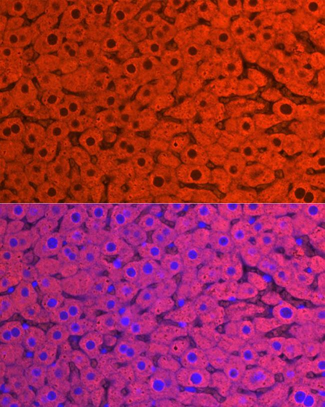 CYP2E1 Antibody in Immunocytochemistry (ICC/IF)