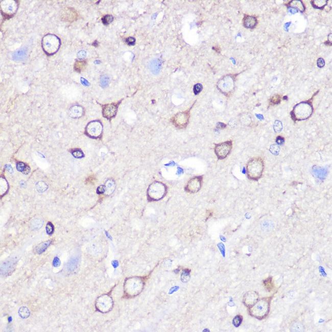 Stathmin 1 Antibody in Immunohistochemistry (Paraffin) (IHC (P))