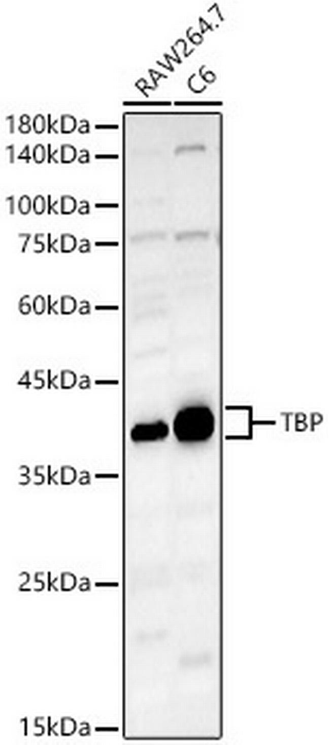 TBP Antibody in Western Blot (WB)