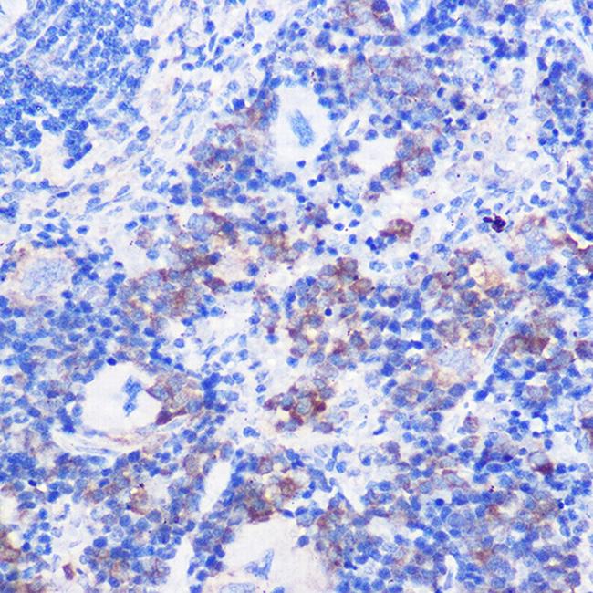 CD24 Antibody in Immunohistochemistry (Paraffin) (IHC (P))