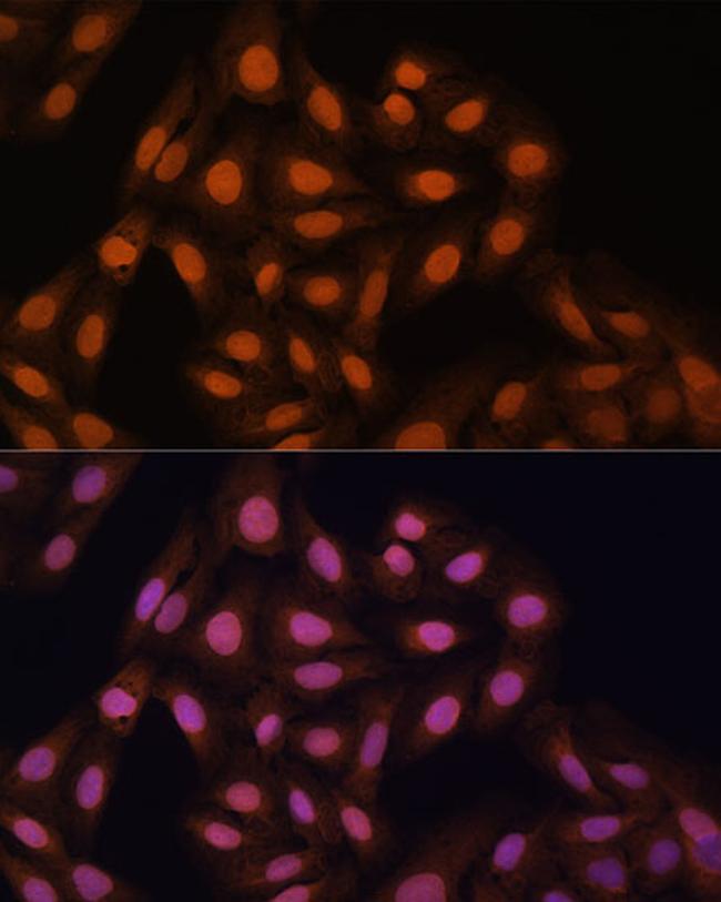 HP1 gamma Antibody in Immunocytochemistry (ICC/IF)