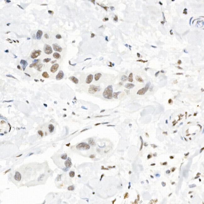 H3K4me3 Antibody in Immunohistochemistry (Paraffin) (IHC (P))