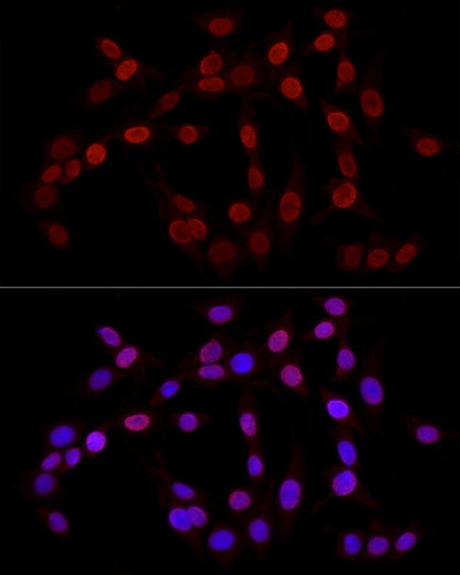 H3K27me3 Antibody in Immunocytochemistry (ICC/IF)