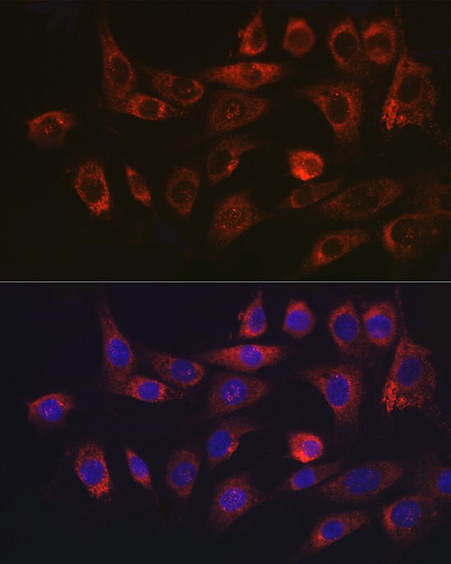 SERPINH1 Antibody in Immunocytochemistry (ICC/IF)