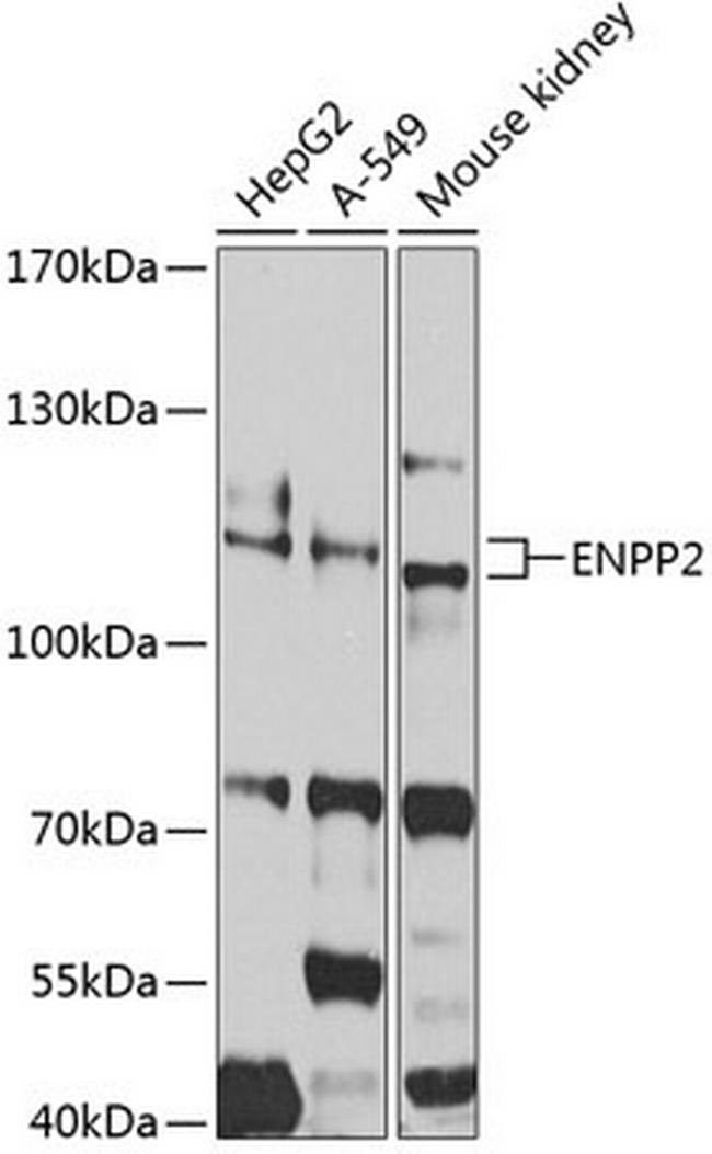 ENPP2 Antibody in Western Blot (WB)