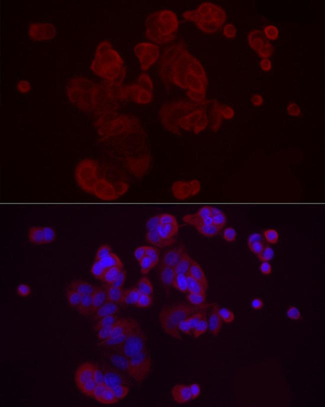 DKK3 Antibody in Immunocytochemistry (ICC/IF)