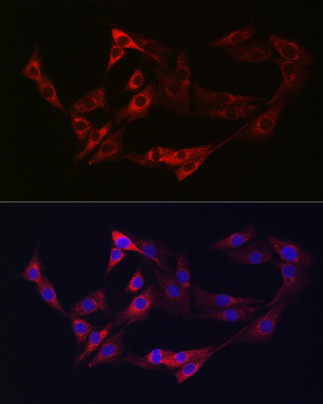 Neuropilin 2 Antibody in Immunocytochemistry (ICC/IF)