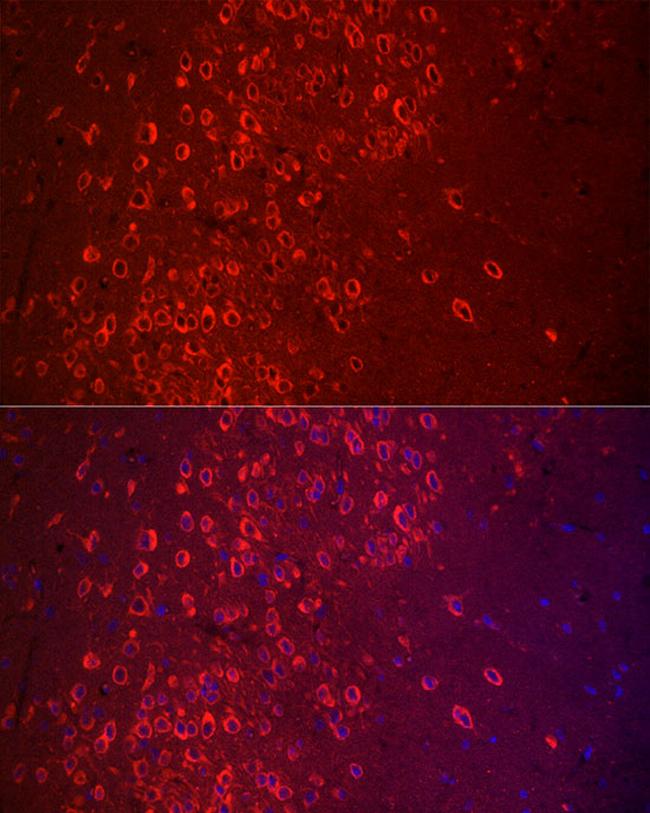 APLP1 Antibody in Immunohistochemistry (Paraffin) (IHC (P))