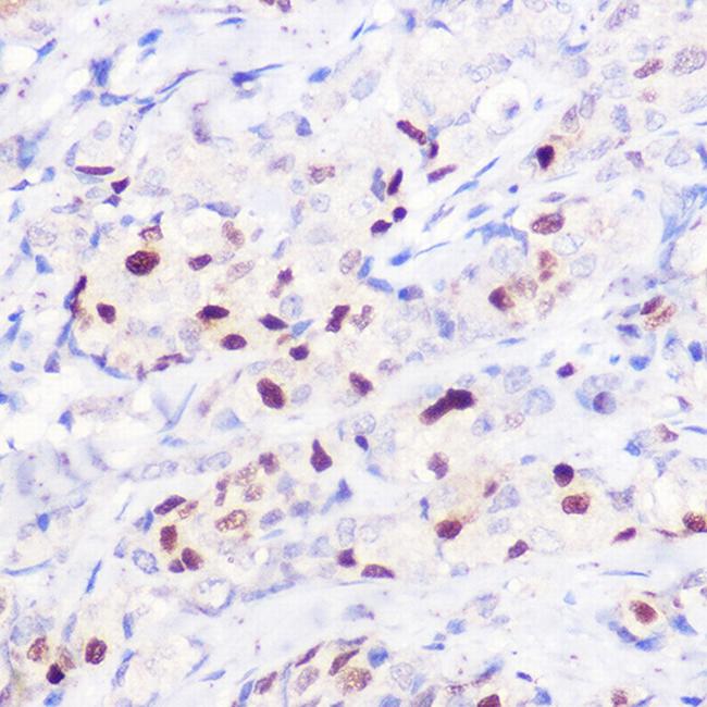 p21 Antibody in Immunohistochemistry (Paraffin) (IHC (P))