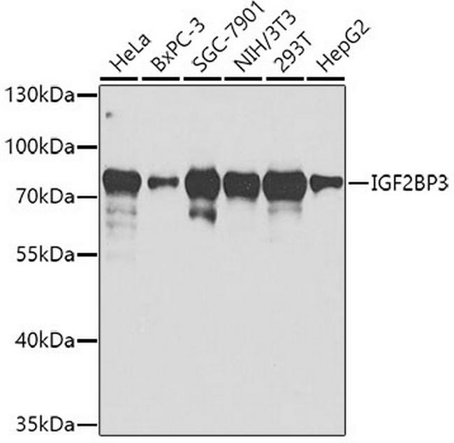 IGF2BP3 Antibody in Western Blot (WB)