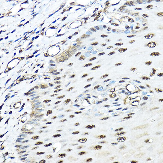 VCP Antibody in Immunohistochemistry (Paraffin) (IHC (P))