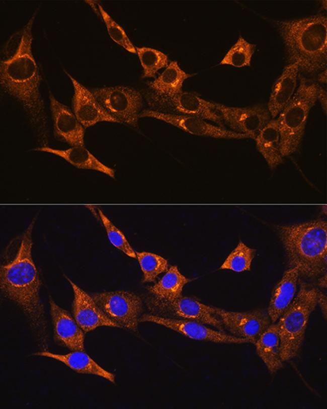 BDKRB2 Antibody in Immunocytochemistry (ICC/IF)