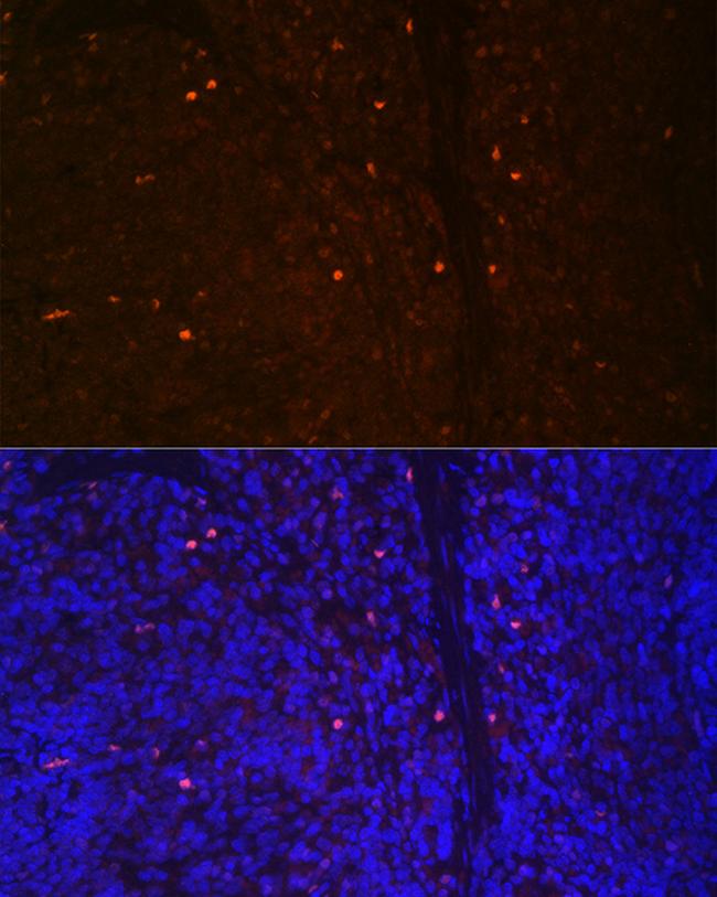 RUNX2 Antibody in Immunocytochemistry (ICC/IF)