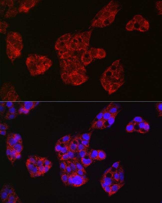 Leptin Receptor Antibody in Immunocytochemistry (ICC/IF)