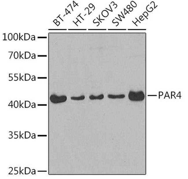 PAR4 Antibody in Western Blot (WB)