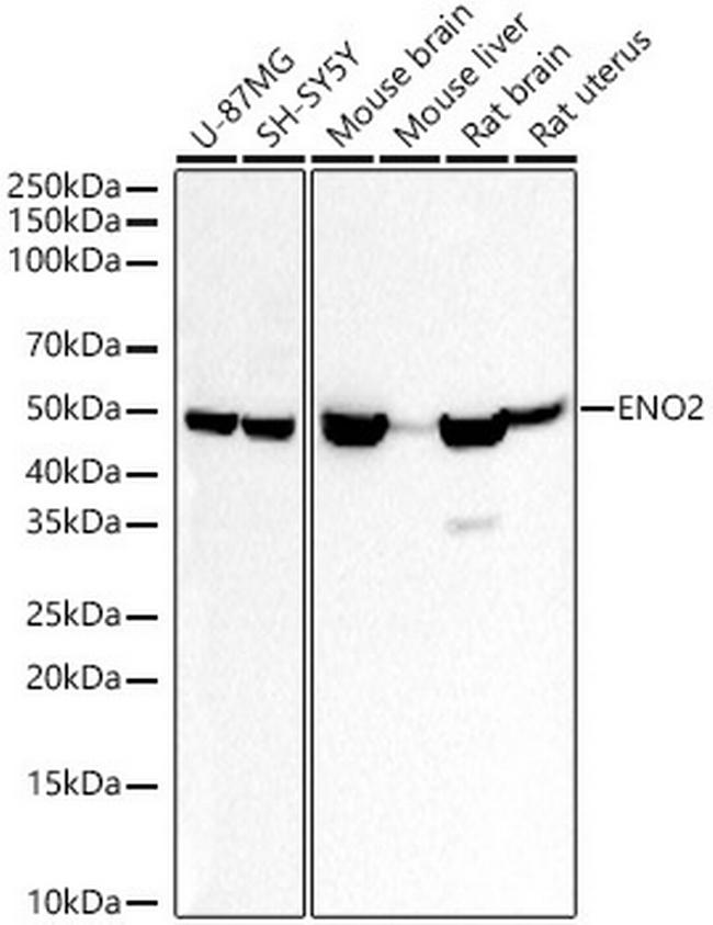 NSE Antibody in Western Blot (WB)