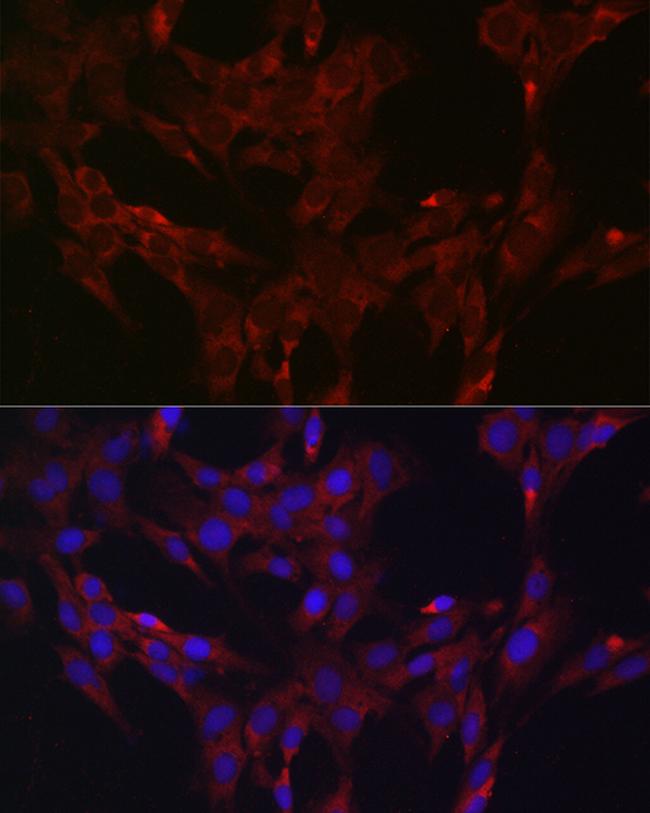 MKP3 Antibody in Immunocytochemistry (ICC/IF)