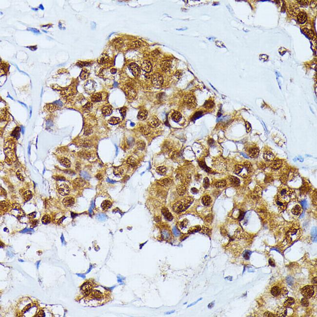 Ubiquitin C Antibody in Immunohistochemistry (Paraffin) (IHC (P))