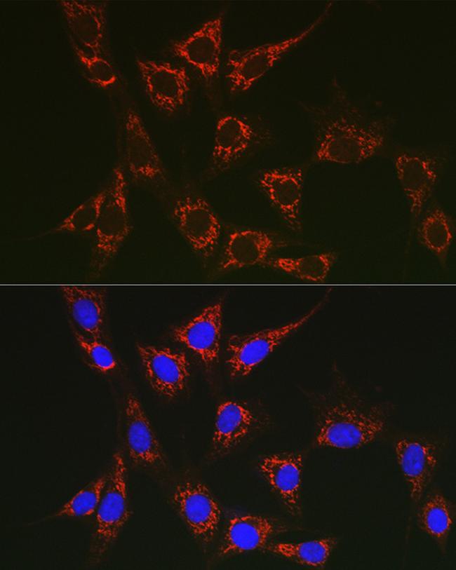 SLC25A6 Antibody in Immunocytochemistry (ICC/IF)