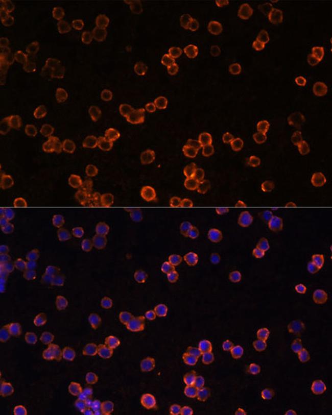 CD39 Antibody in Immunocytochemistry (ICC/IF)