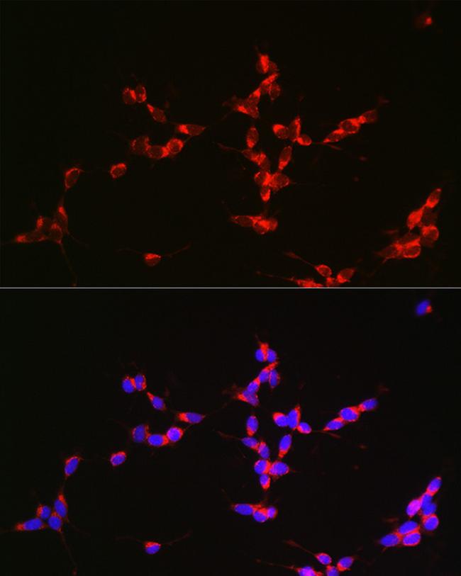 Glutaminase Antibody in Immunocytochemistry (ICC/IF)