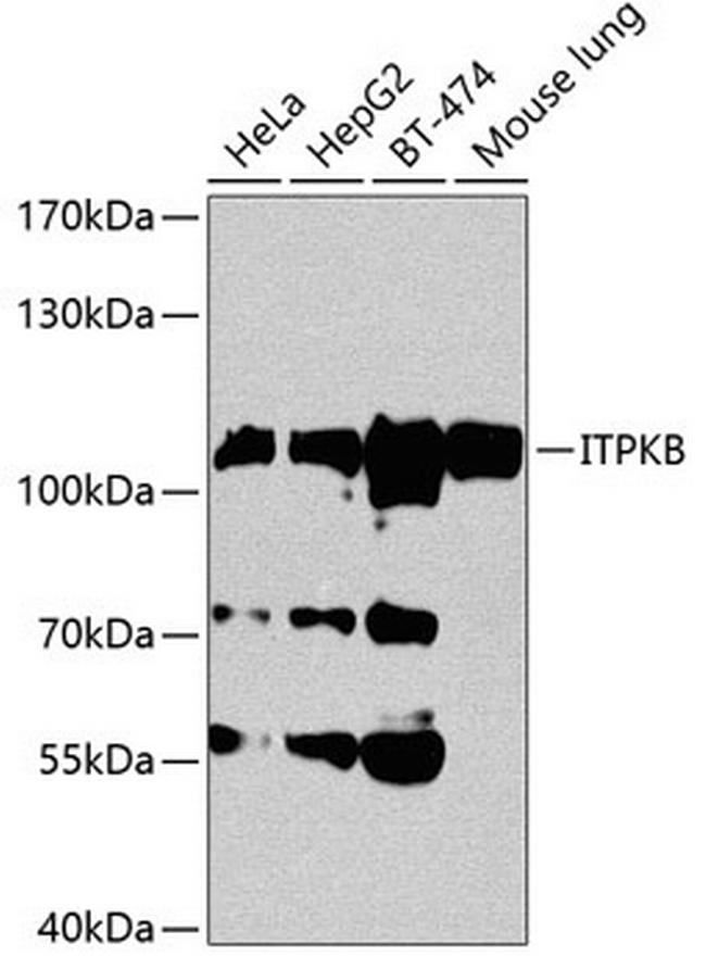 ITPKB Antibody in Western Blot (WB)