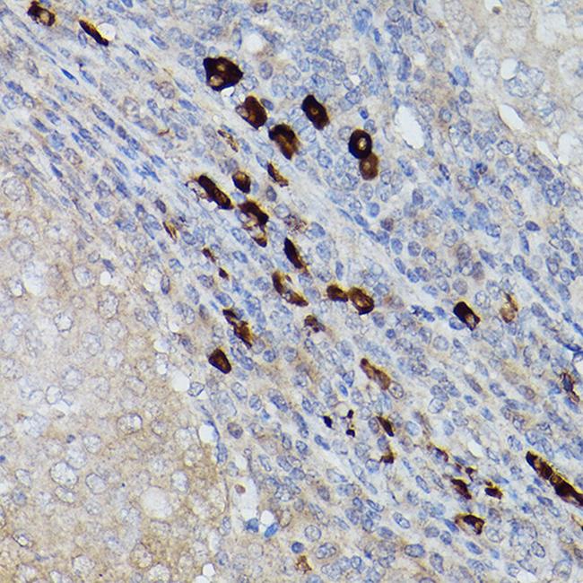 UBE2L6 Antibody in Immunohistochemistry (Paraffin) (IHC (P))